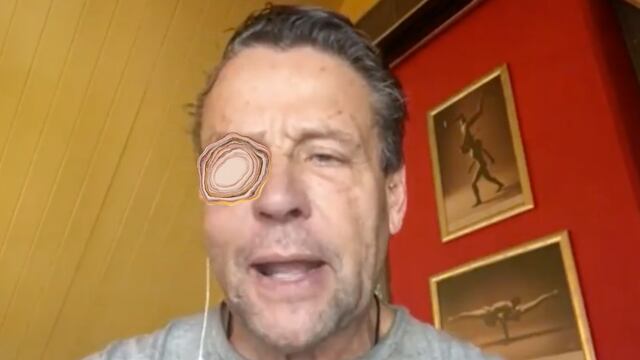 Alfredo Adame a un día después de ser golpeado.