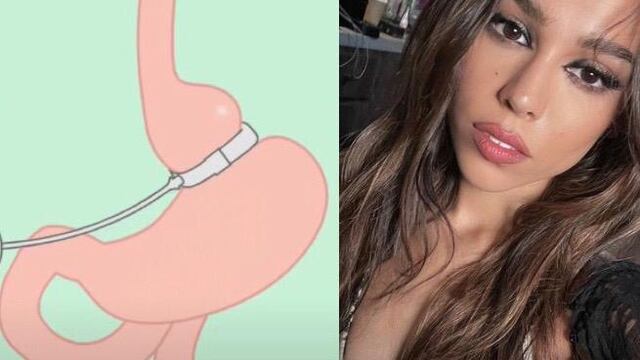 Banda gástrica / Danna Paola