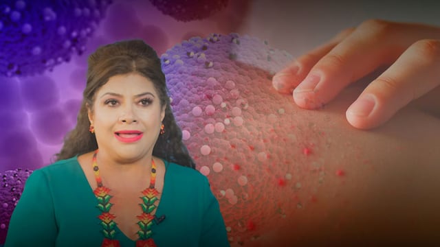 Clara Brugada llama a no estigmatizar alcaldías de CDMX por brote de sarampión