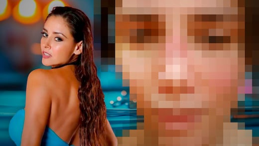 Así luce Dorismar tras una cirugía estética con complicaciones