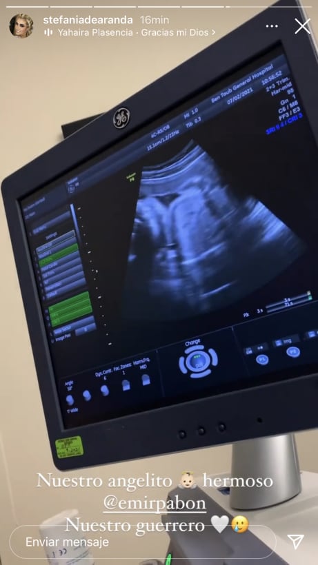 Ultrasonido del hijo de Stefanía de Aranda