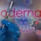 Moderna anuncia desarrollo de vacuna contra el hantavirus