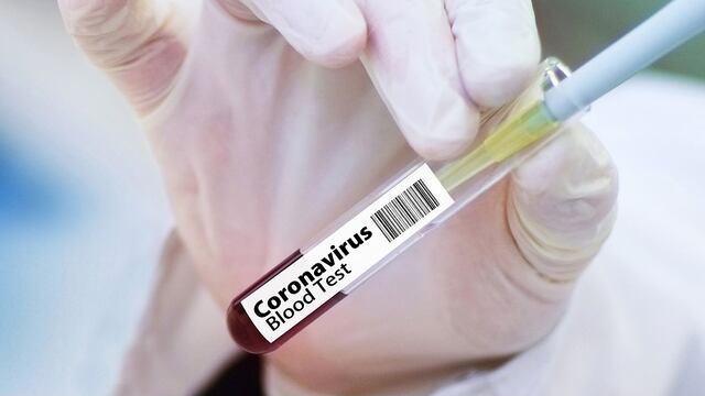 Prueba coronavirus