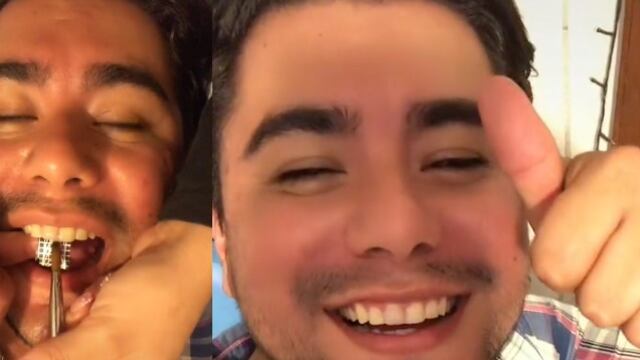 novia manicurista le aplicó una uña en el diente