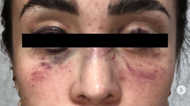 Agresión contra Kenya Mirelle