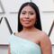 Yalitza Aparicio tiene una enfermedad en la piel