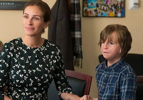 Extraordinario, película que habla del síndrome de Treacher Collins