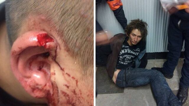 Policía herido