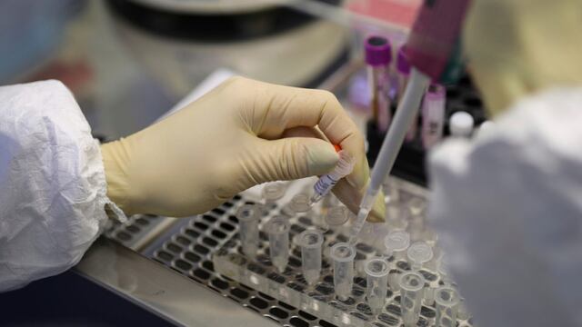 Pruebas para coronavirus.