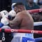 Andy Ruiz se rompe la muñeca en su pelea contra Jarrell Miller