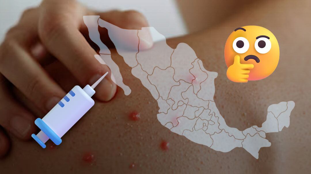 Secretaría de Salud reporta descenso de contagios de sarampión tras caso mortal en Jalisco