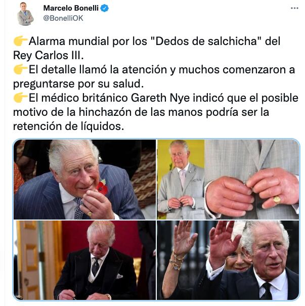 Manos del Rey Carlos III