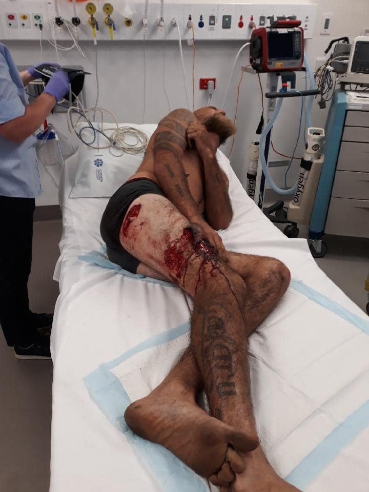 Herido
