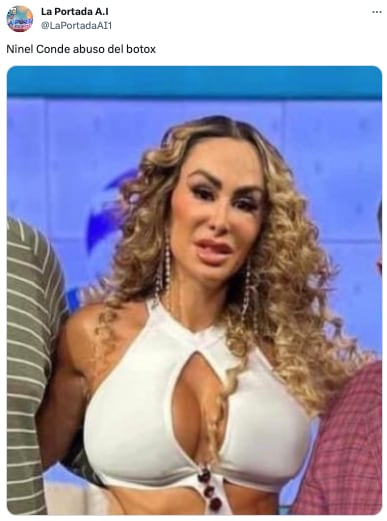 Ninel Conde, botox