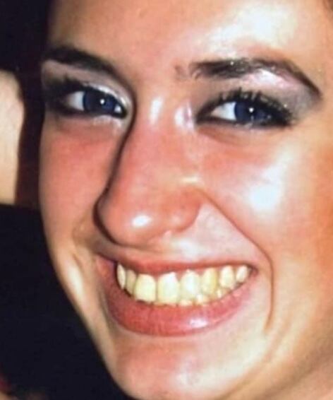 Anastasia Pokreshchuk antes de las cirugías