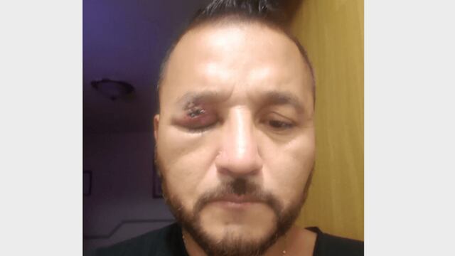 Pedro Carrizales, alias el 'Mijis.