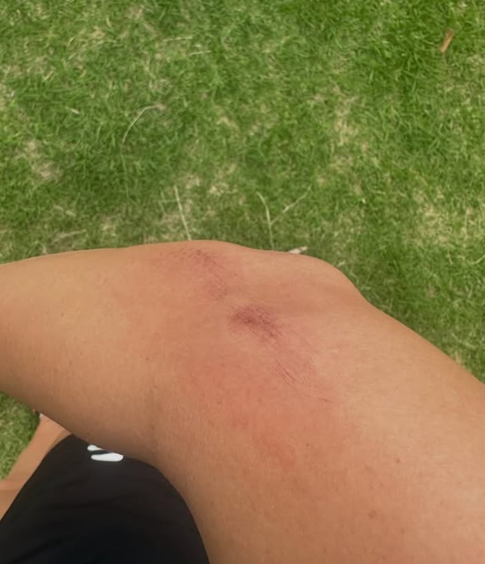 Catherine Mayran Oliver, pentatleta, fue agredida en Bosque del Ocotal