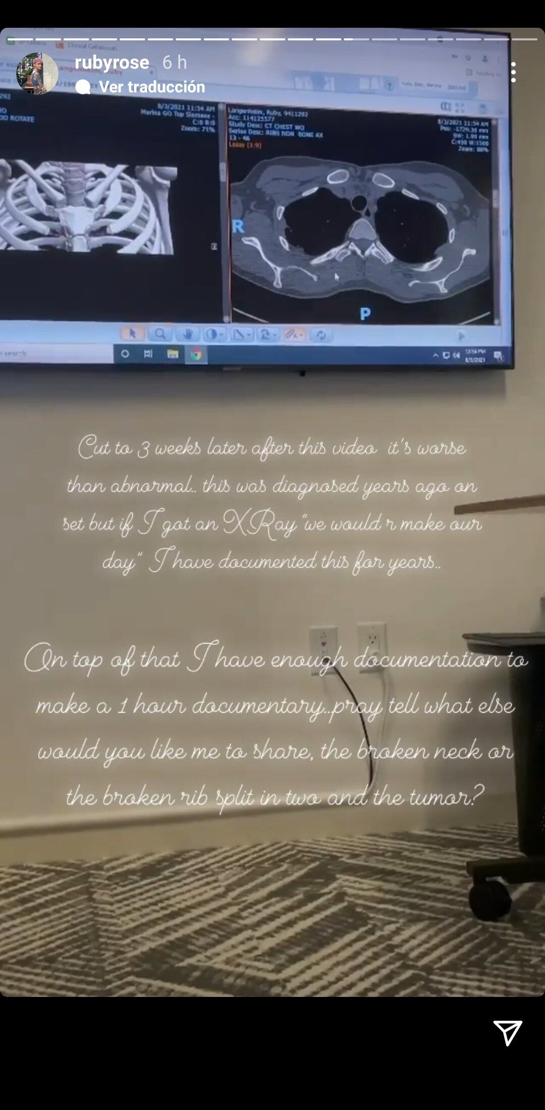 Denuncia de Ruby Rose sobre 'Batwoman'