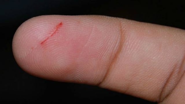 La profundidad del corte no es tanta y tampoco es pareja.