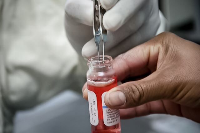 19 mil 800 pacientes se encuentran en lista de espera para recibir algún trasplante de órgano o tejido