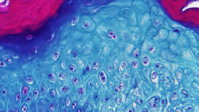 Imagen ampliada con un microscopio de una muestra de piel de un mono infectado con el virus de la viruela del mono