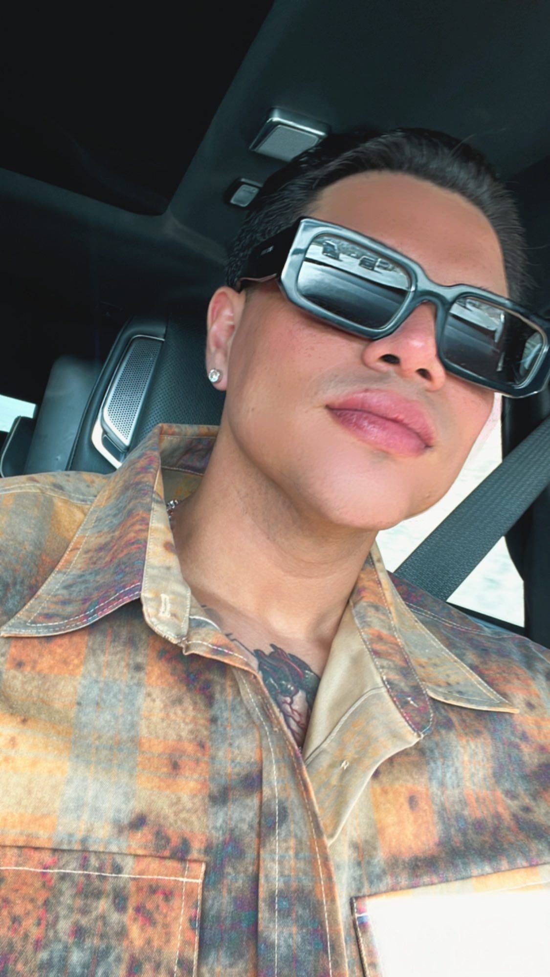 Eduin Caz se muestra en selfie y ya se ve que se inyectó los labios.