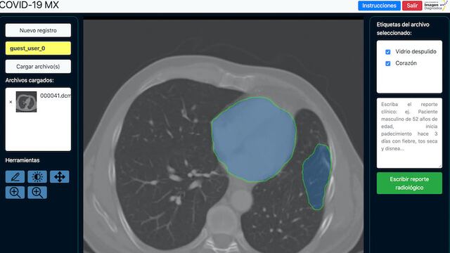 Diagnóstico mediante radiología.