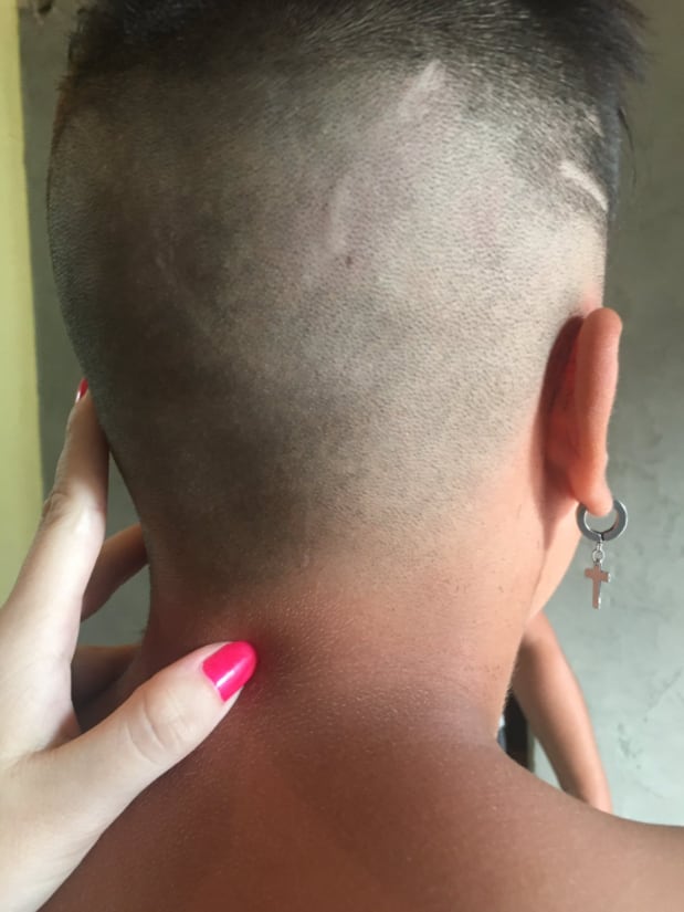 Corte de cabello fallido
