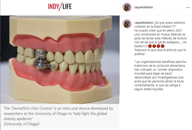 Post Instagram; Raquel Lobatón critica candado para dientes.
