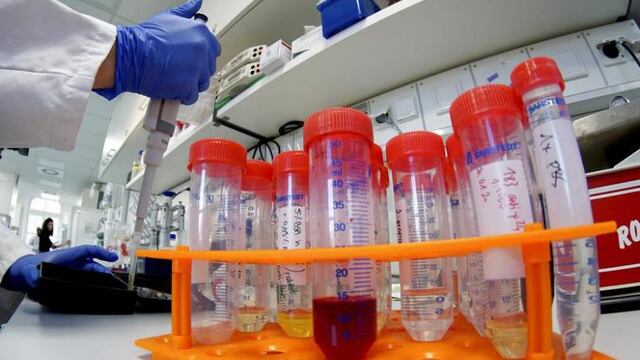Pruebas para detectar coronavirus.