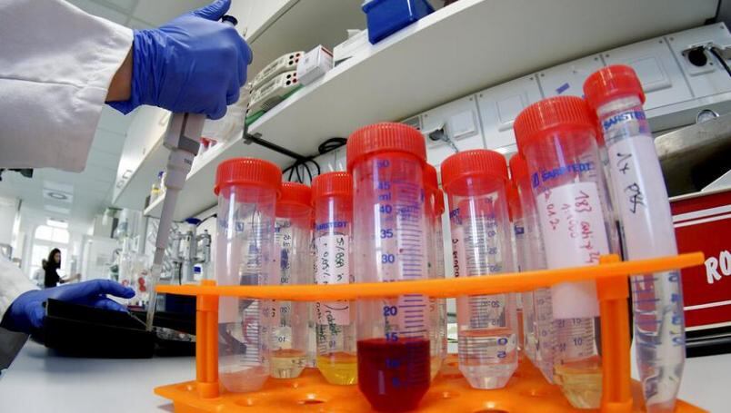 Pruebas para detectar coronavirus.