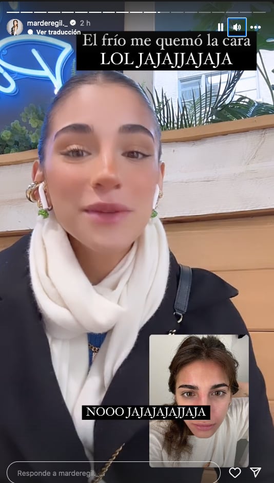 Mar de Regil se quemó la cara como su mamá Bárbara de Regil, pero en Nueva York.