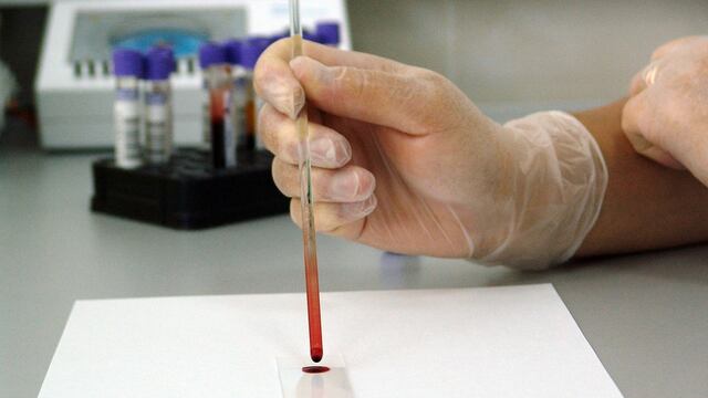 La sangre artificial podría usarse con heridos de gravedad de cualquier grupo sanguíneo.