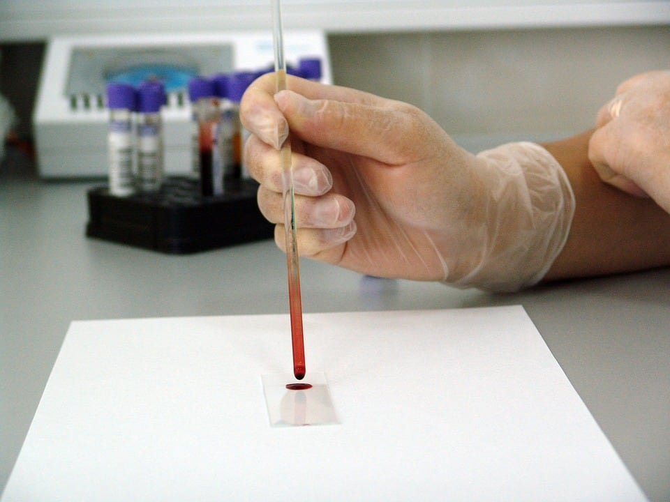 La sangre artificial podría usarse con heridos de gravedad de cualquier grupo sanguíneo.