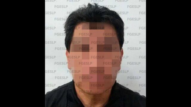 Sebastián ’N’ de 52 años fue denunciado por una mujer que se practicaría una cirugía estética.