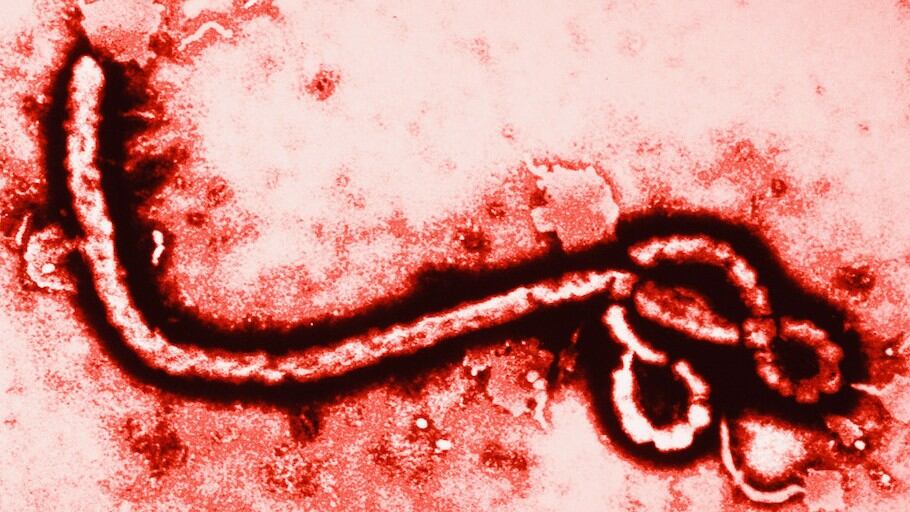 Virus del Ébola