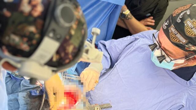 El paciente tenía 50% de probabilidad de sobrevivir.