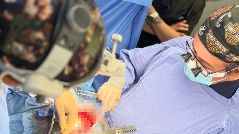 Especialistas del ISSSTE en Morelos salvan vida de paciente con cirugía de corazón abierto