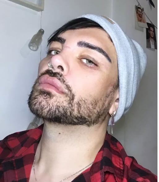 Se operó para parecerse a Ricky Martin