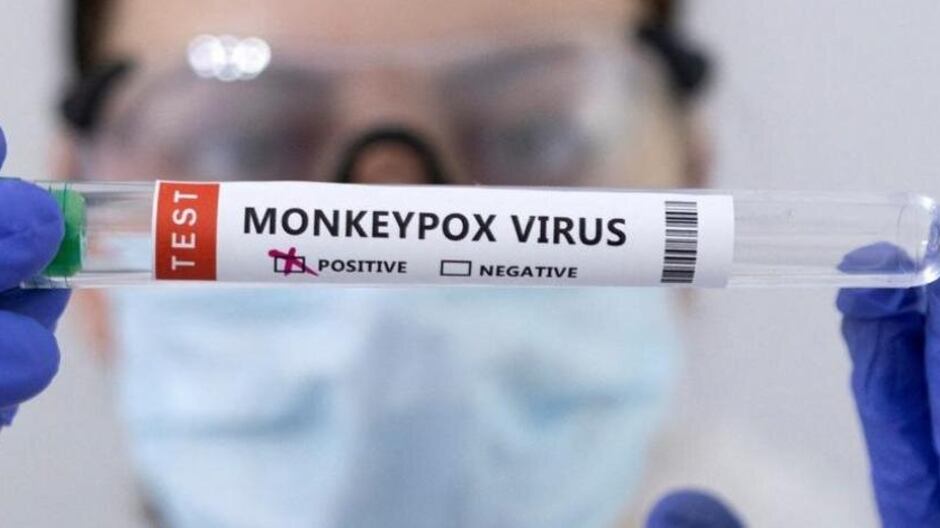 Viruela del mono: Cofepris analiza autorizar vacuna contra mpox