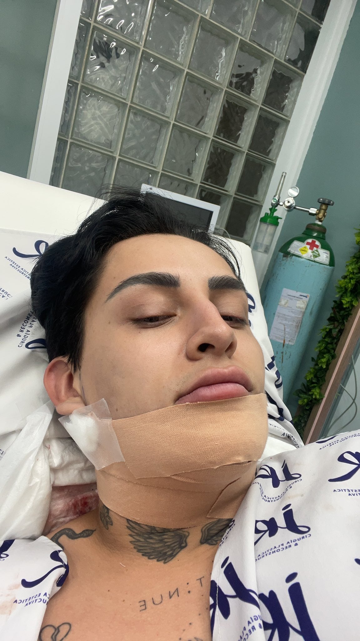 Kunno muestra orgulloso su lipopapada