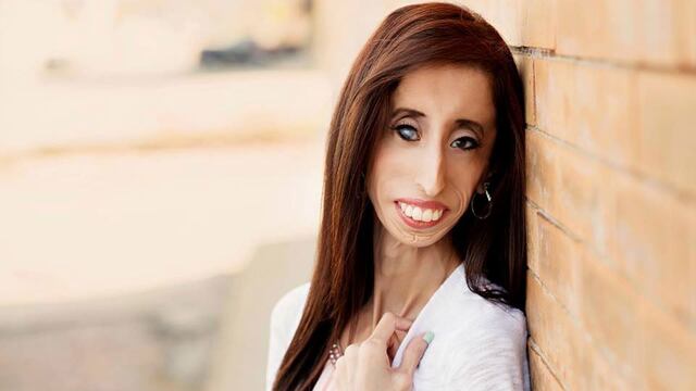 La historia de la mujer "más fea del mundo"