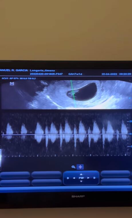 Ultrasonido de Jimena Longoria