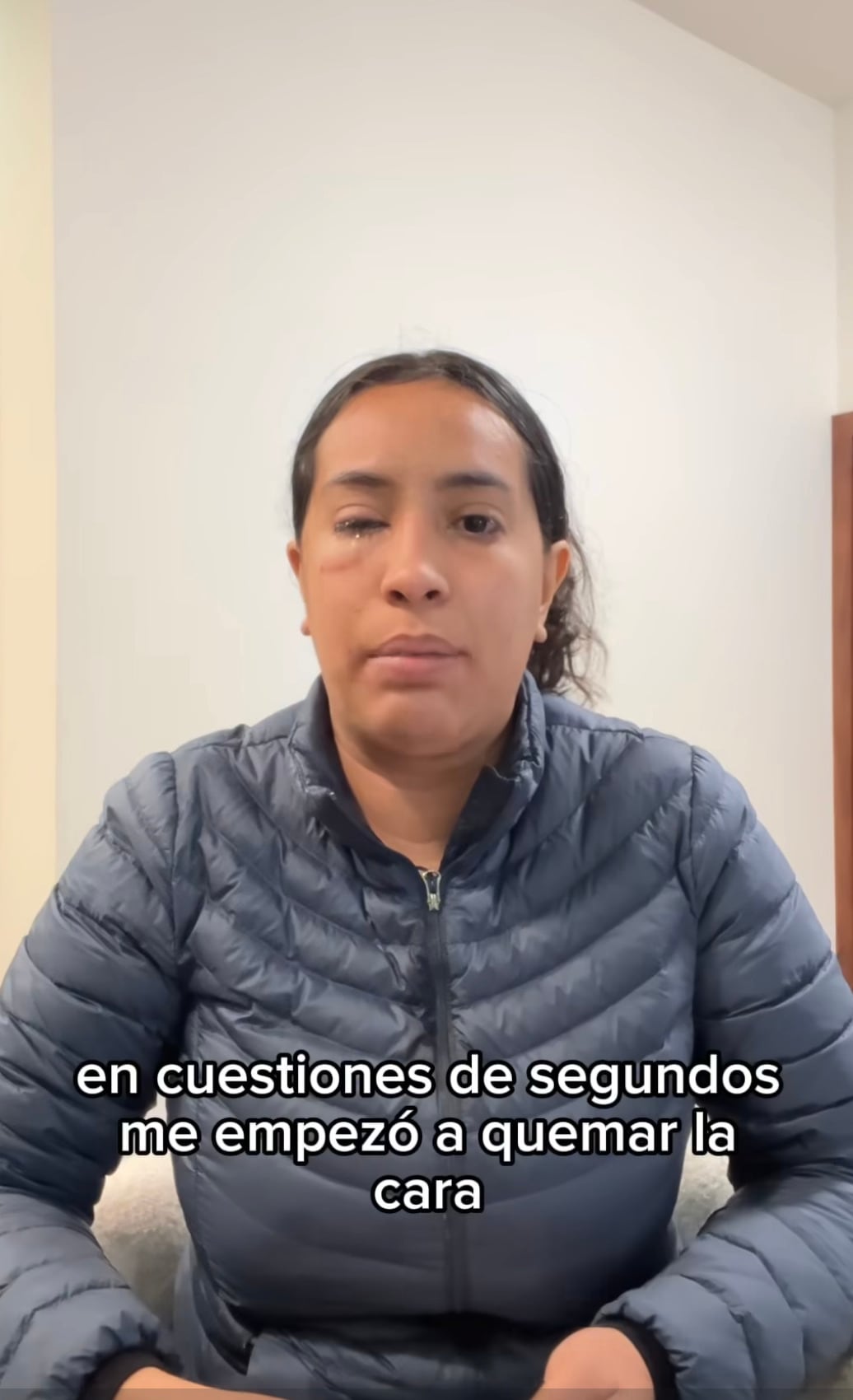 Fernanda Sánchez, víctima de ataque con ácido