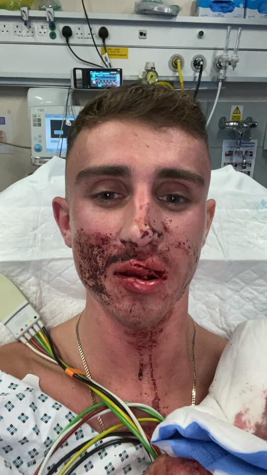 Jack Woolley, el taekwondista en el hospital.