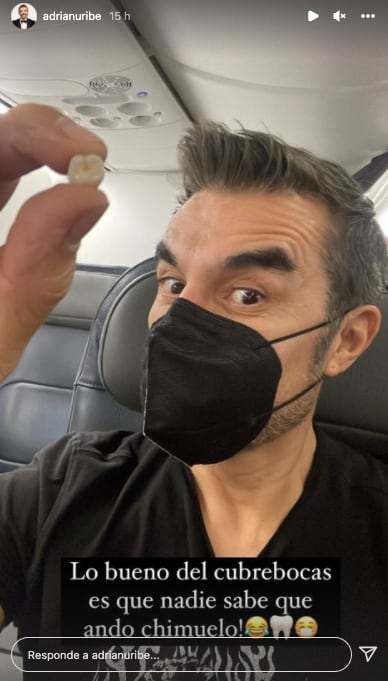 Adrián Uribe se burla de haber quedado chimuelo