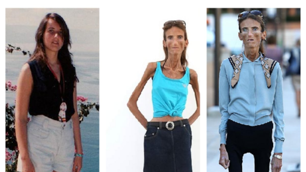 Valeria Levitin: la mujer más "flaca" del mundo