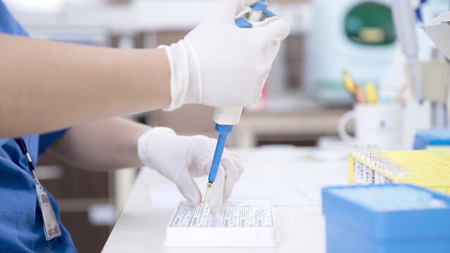 Pruebas de laboratorio