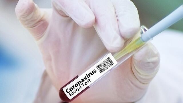 Coronavirus
