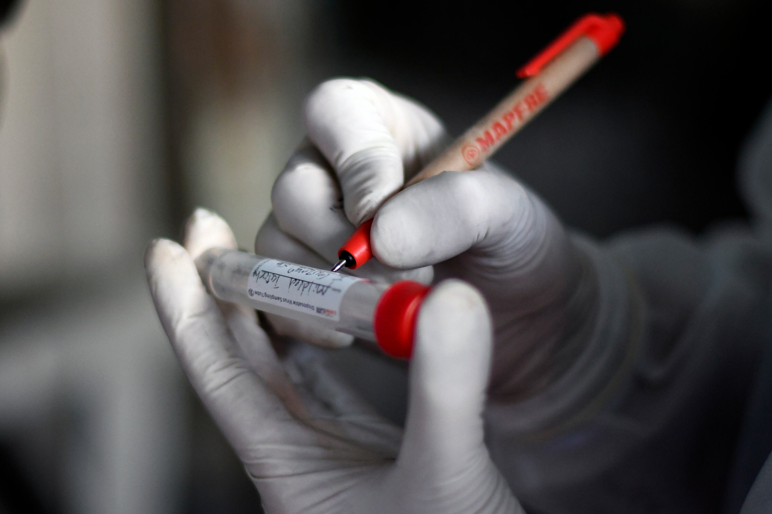 Prueba de sangre